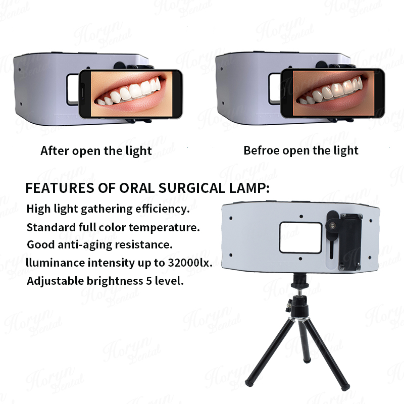 歯科用フラッシュライト,歯科医の写真機器,LED口腔充填ライ - Photography Lighting Flash のレビューと価格